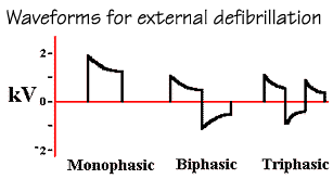 Waveform for external defibrillation.
