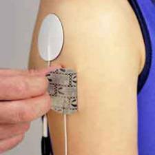 Transcutaneous electrical nerve stimulation (TENS)